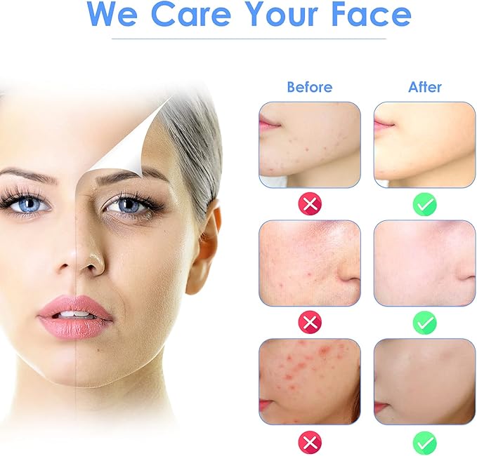 Facial Skin Scrubber